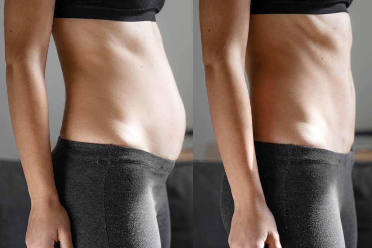 Post-Pregnancy: What Happens to Your Abdominal Muscles After Birth Epping Green