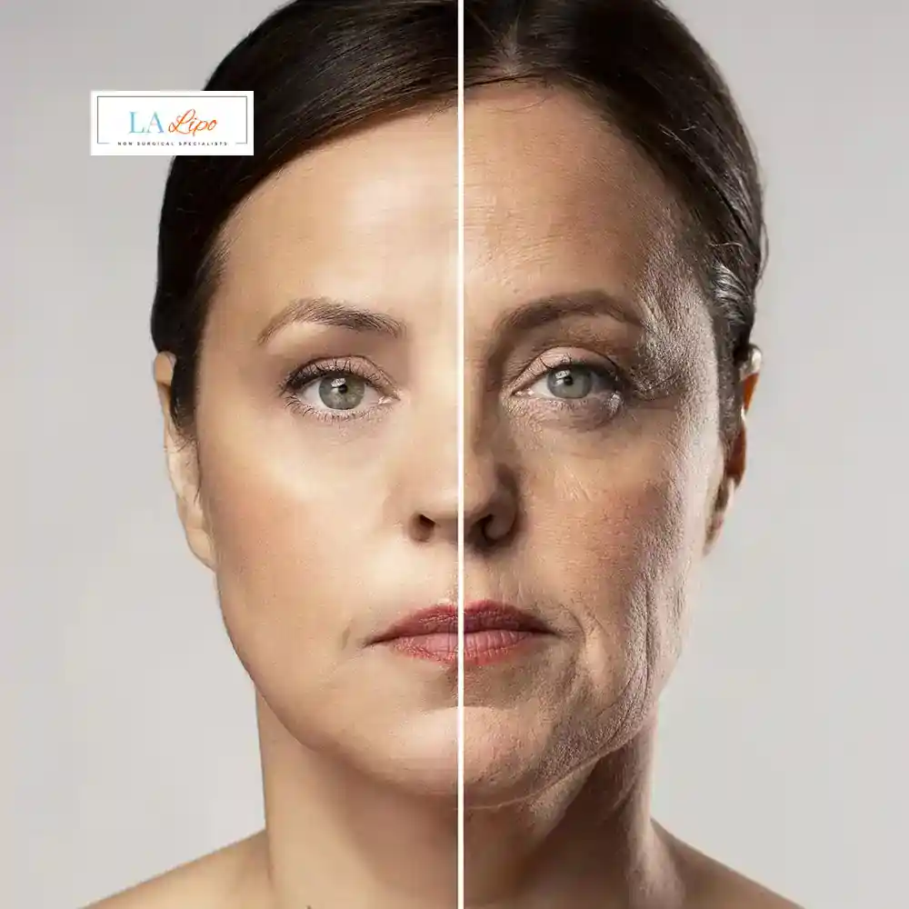 How Can You Tell If Non-Surgical Skin Tightening Is Right for You Epping Green?