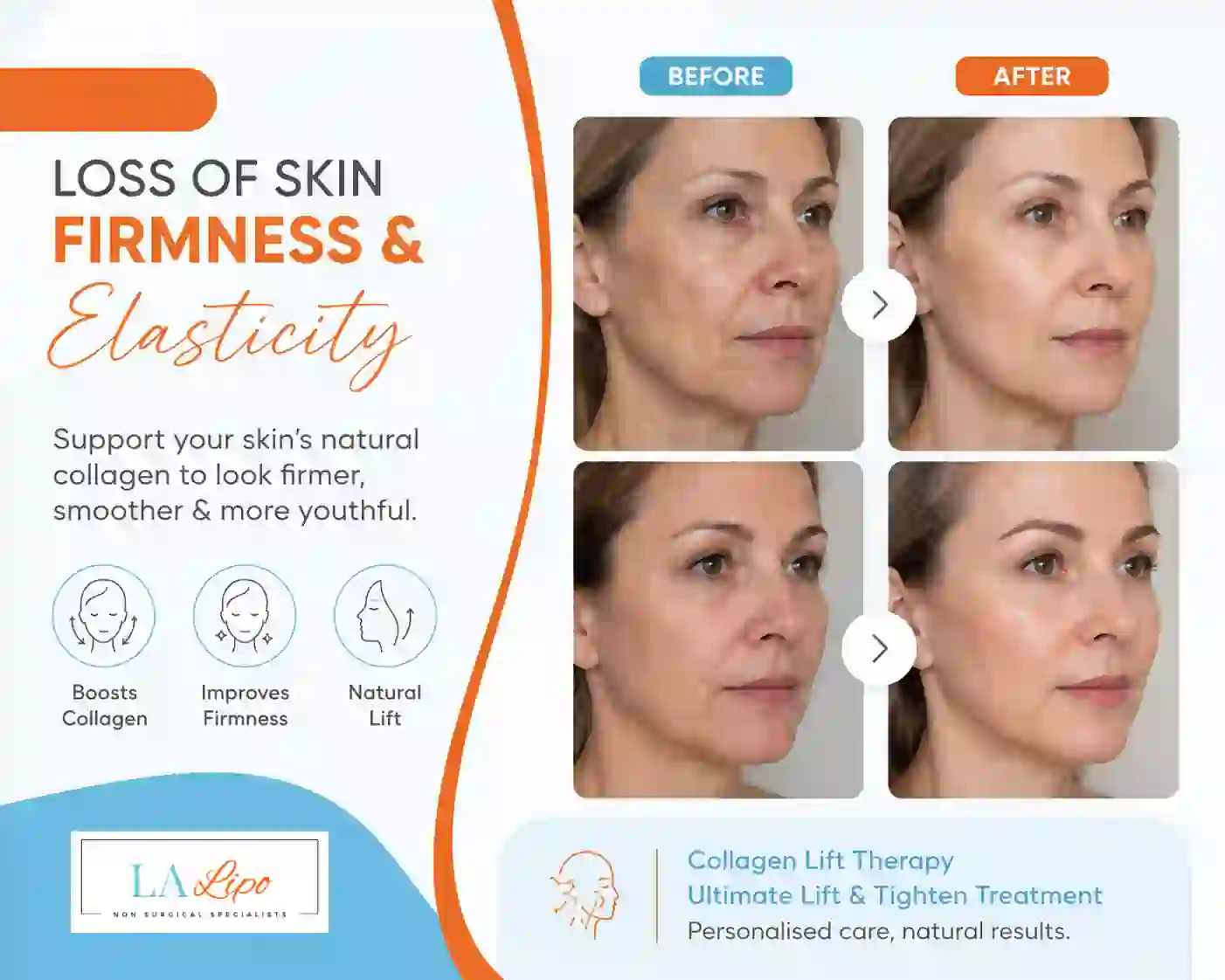 Sign #7: Loss of Skin Firmness and Elasticity Epping Green