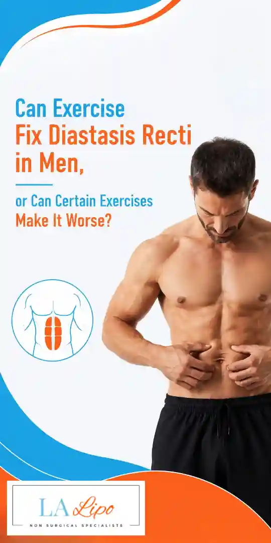 Can Exercise Fix Diastasis Recti in Men, or Can Certain Exercises Make It Worse Epping Green?