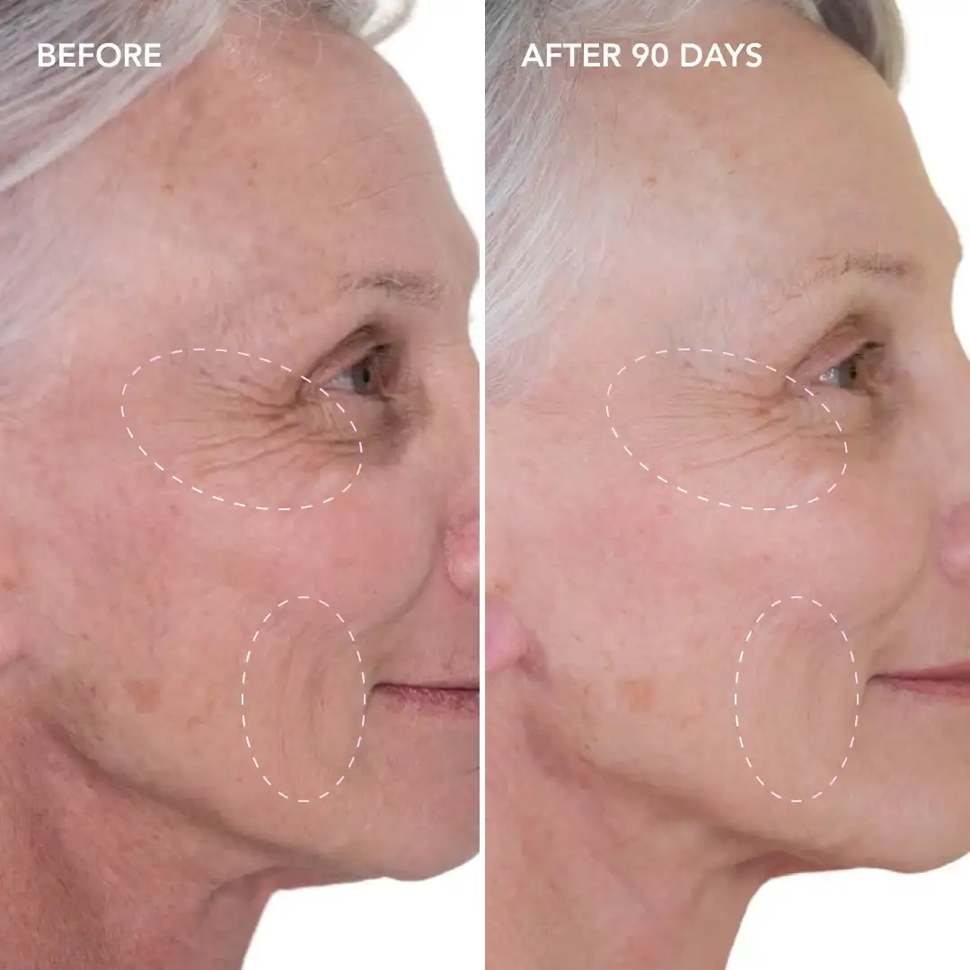 When will you see results Epping Green